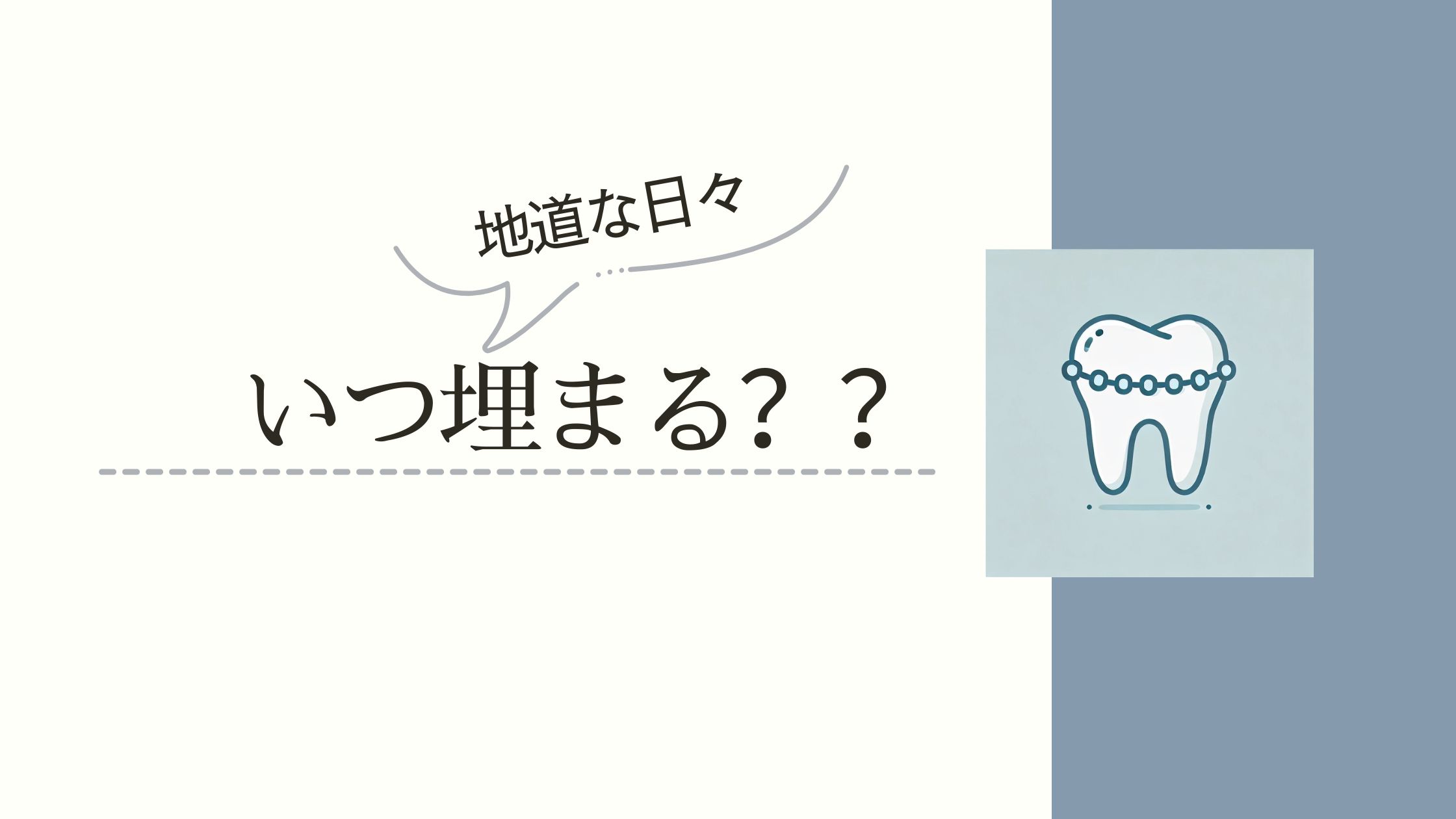 歯科矯正で抜歯してから抜歯跡・隙間が埋まるまでどれくらいかかるのかをレポ